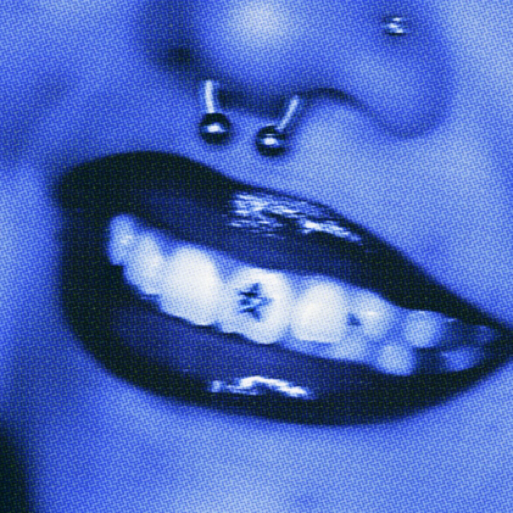 Tooth Gem Removal at Solecita Gems in Los Angeles, CA