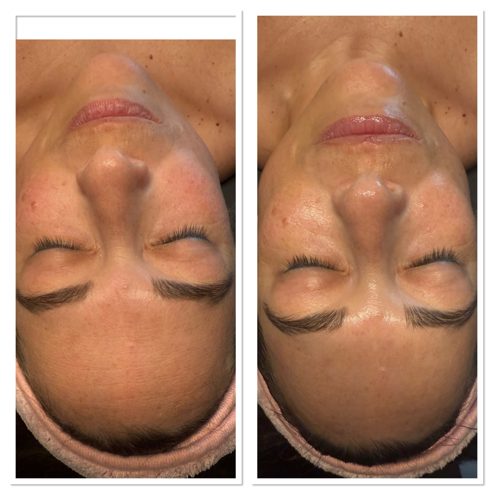Glass Skin DermaPeel at GlowHaus Collective By Monét in Camden, AR