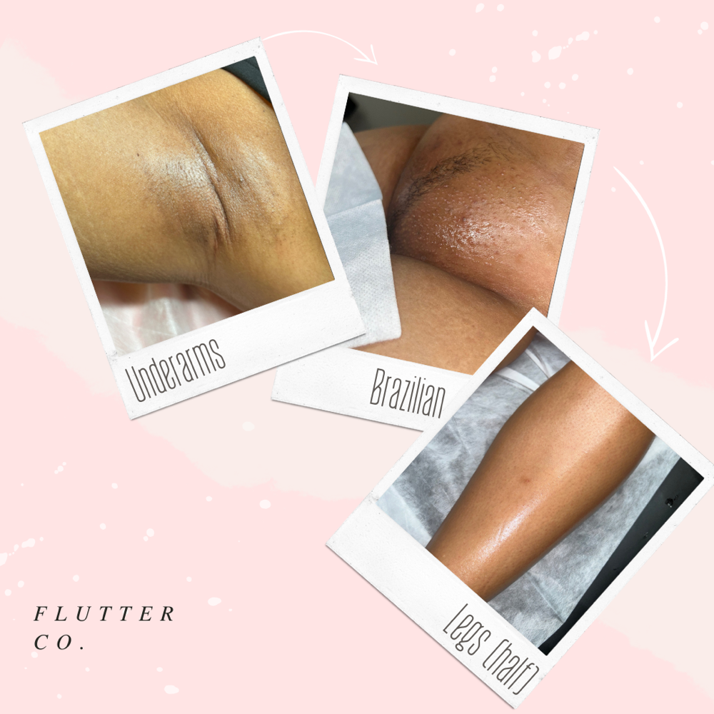 Underarms~Brazilian~Legs(half)