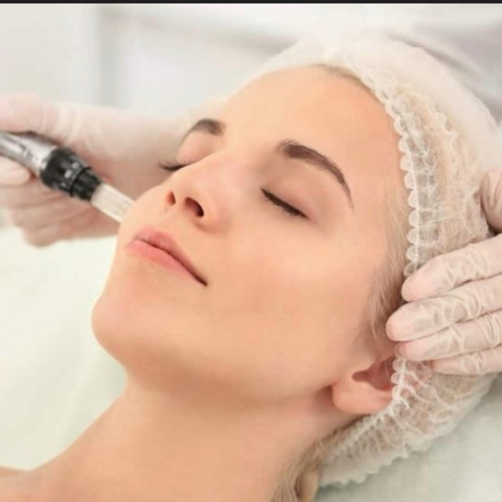 Microneedling with Pure Salmon DNA at Seoul Glow Spa in Seattle, WA