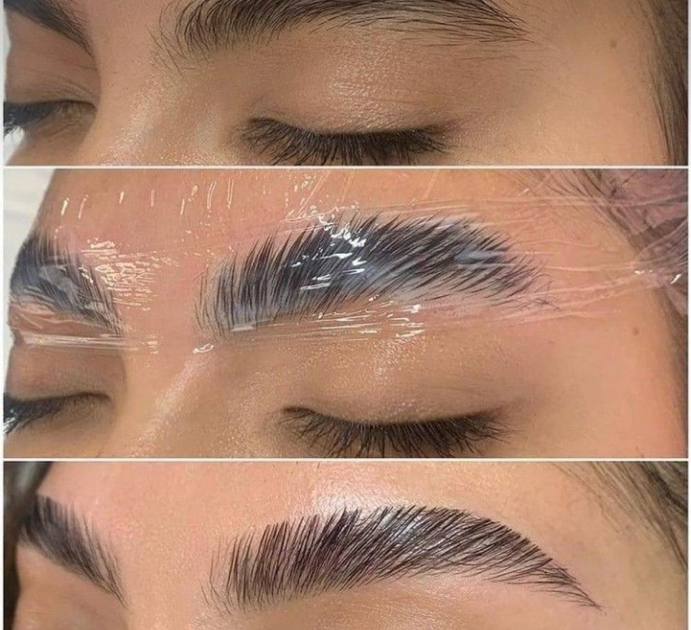 Brow Lamantion