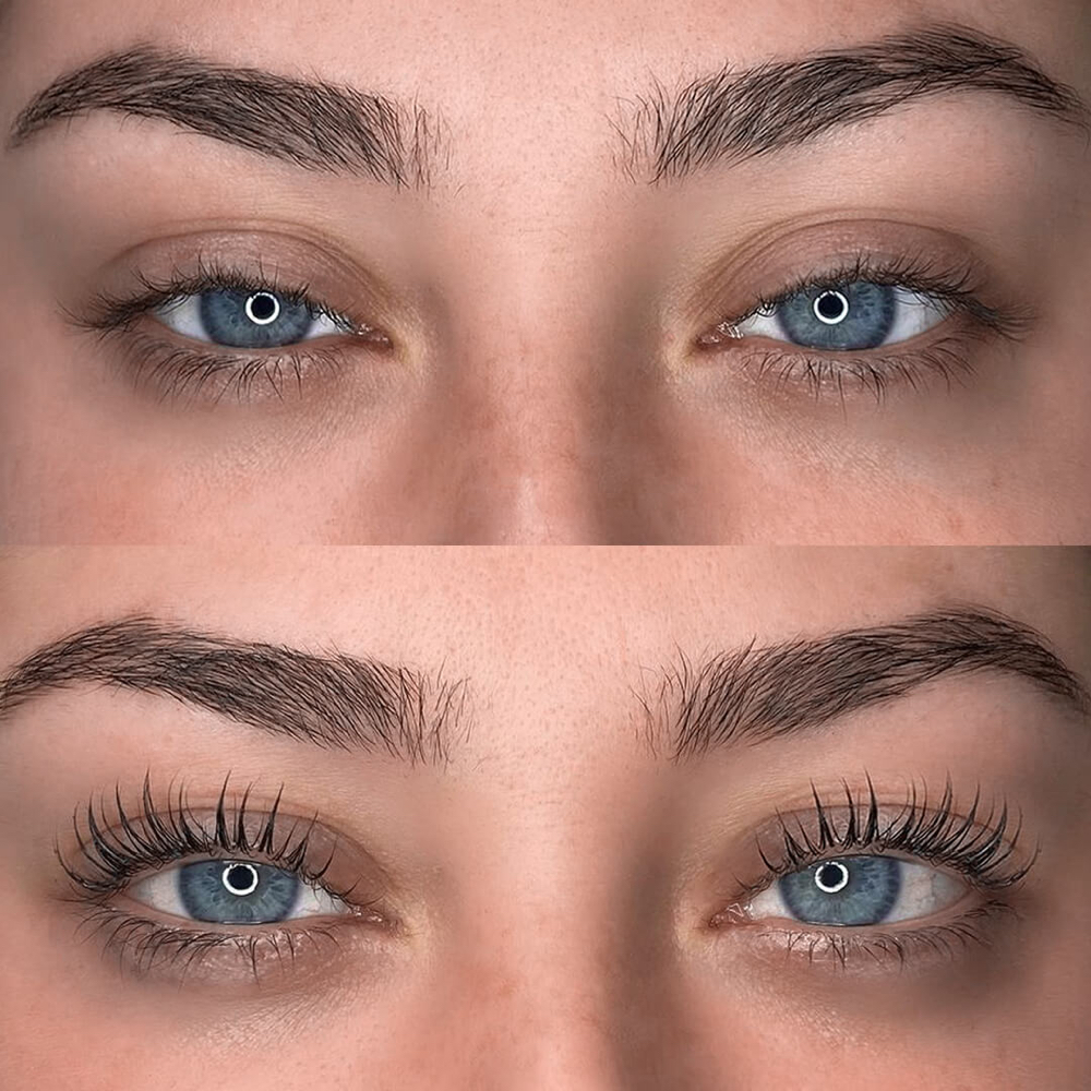 Lash Lift