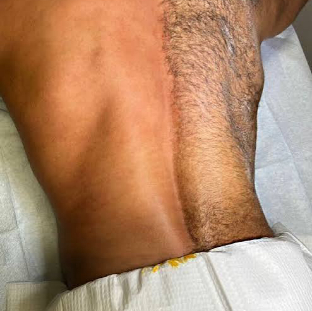 Full Back Wax at Angelic Skin & Body in Oak Park, IL