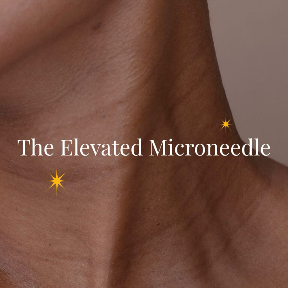 The Elevated Microneedle at Ox & Moon Studio in Springfield, MO