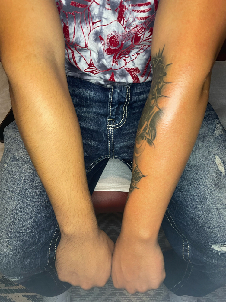 Full Arms