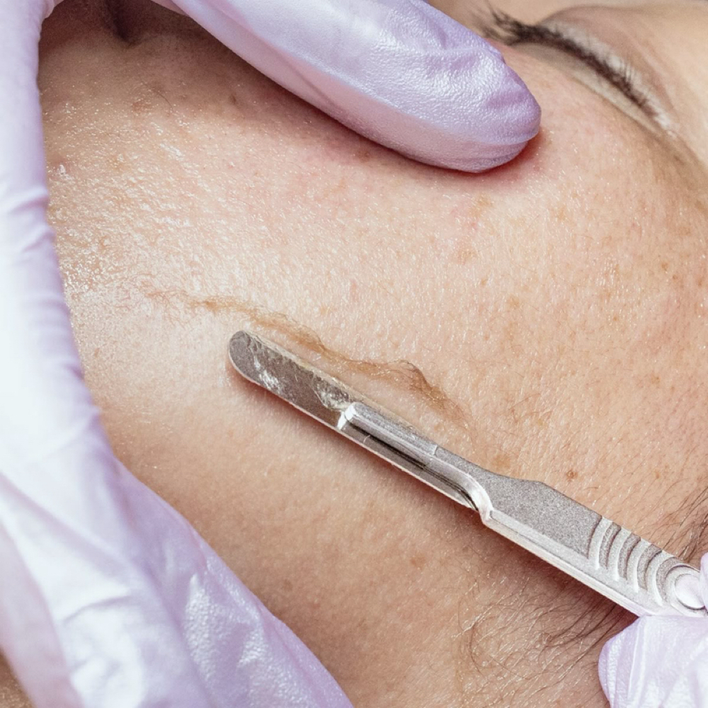 Dermaplane Facial at The Body Haven in Wagener, SC