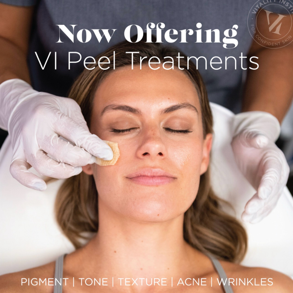 VI Peel Advanced Treatment+peptide at Skin & Syringe Aesthetics in Rockwall, TX