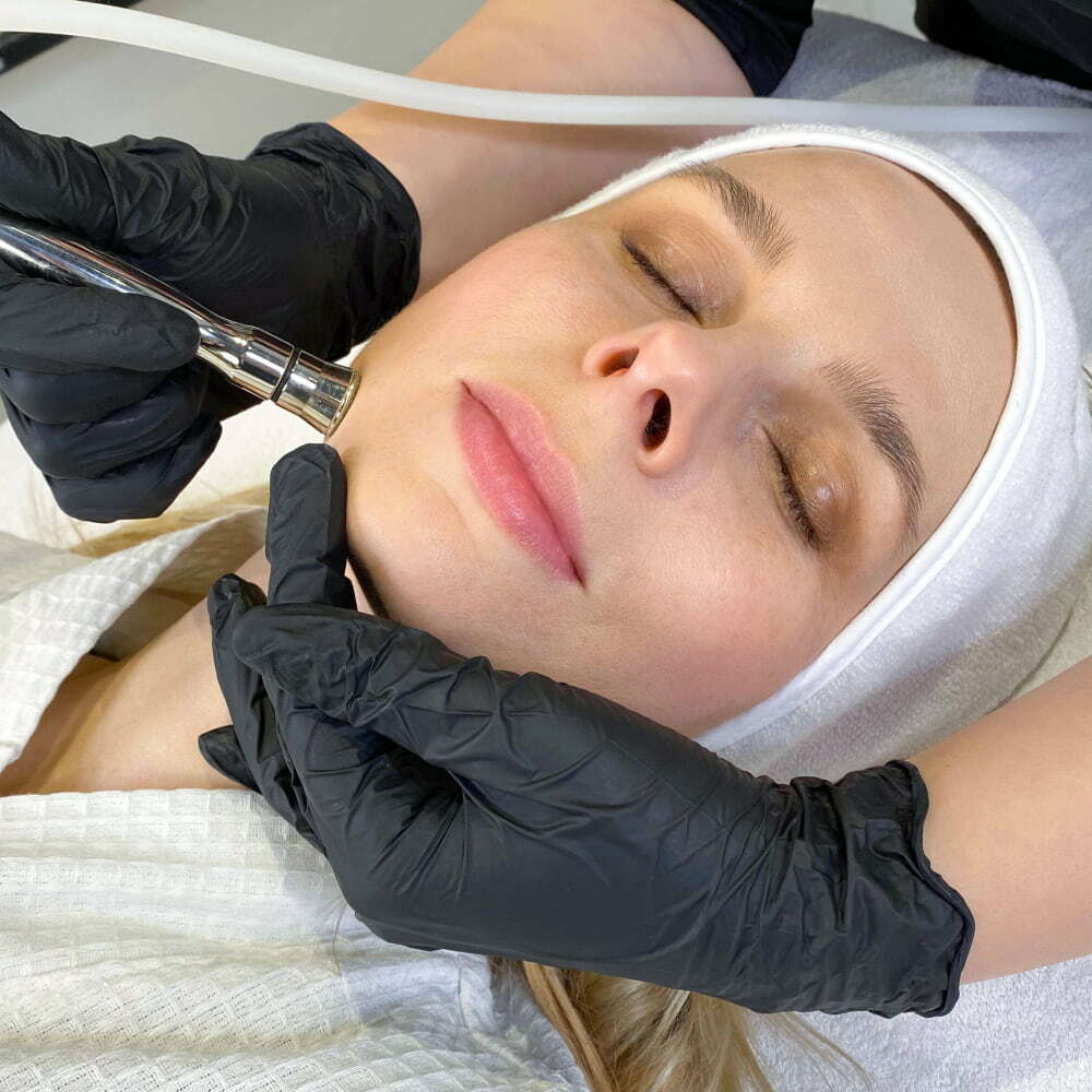 Microdermabrasion Facial