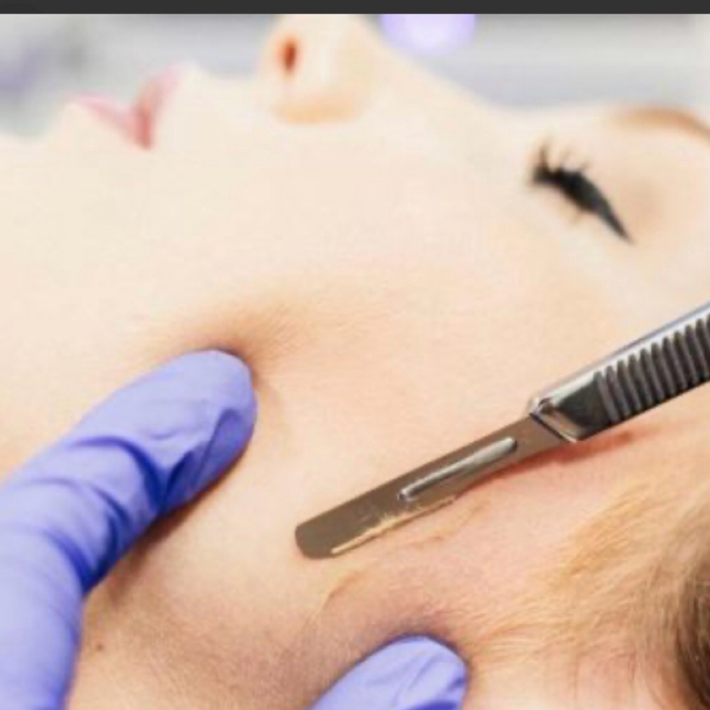 Dermaplaning Facial at Revive Beauty Co. in Fenton, MI