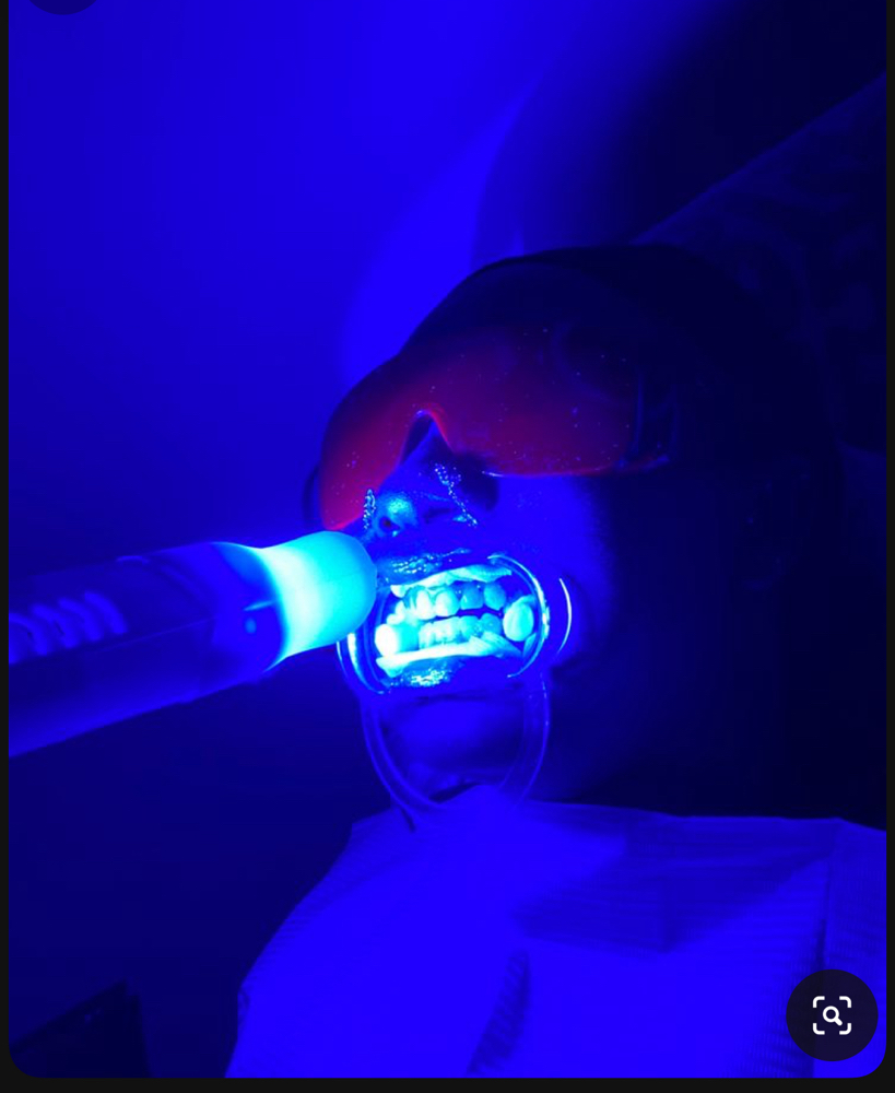 Platinum Teeth Whitening Session