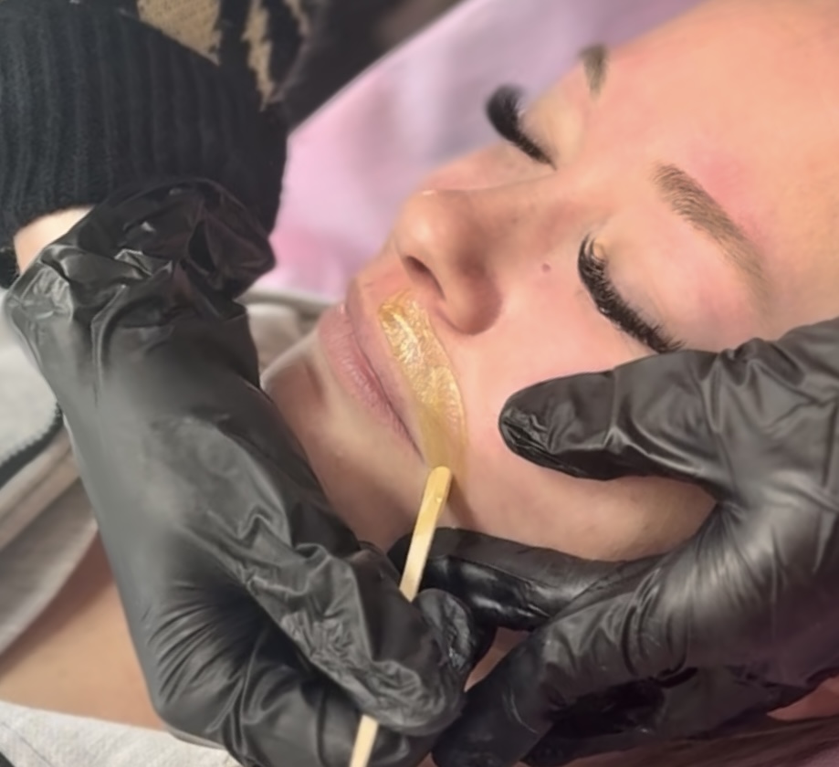 Upper Lip | Hair Removal