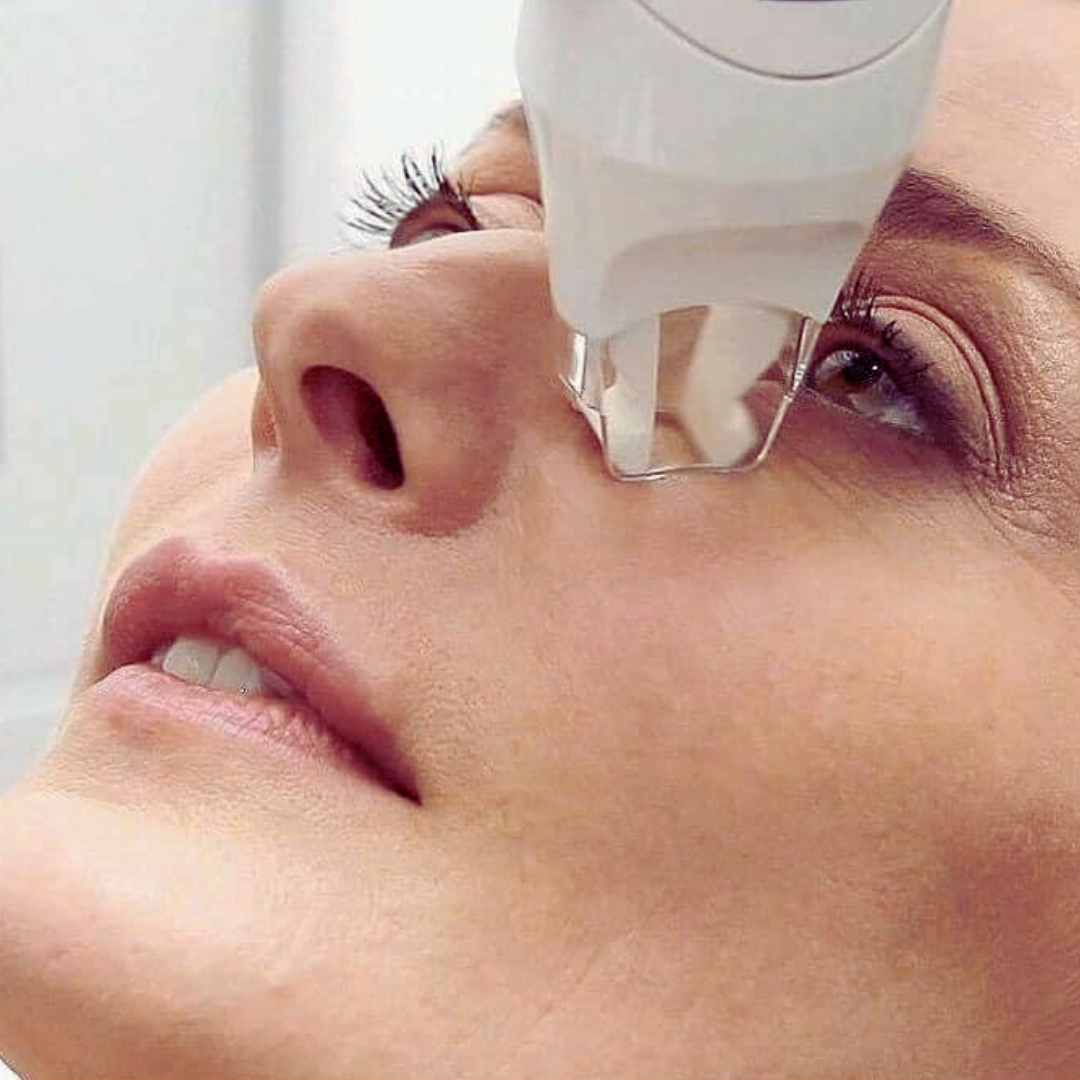 LPG Eye Lift & Drainage