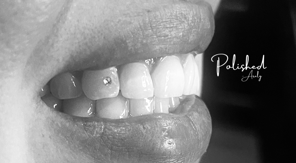 Teeth Gem