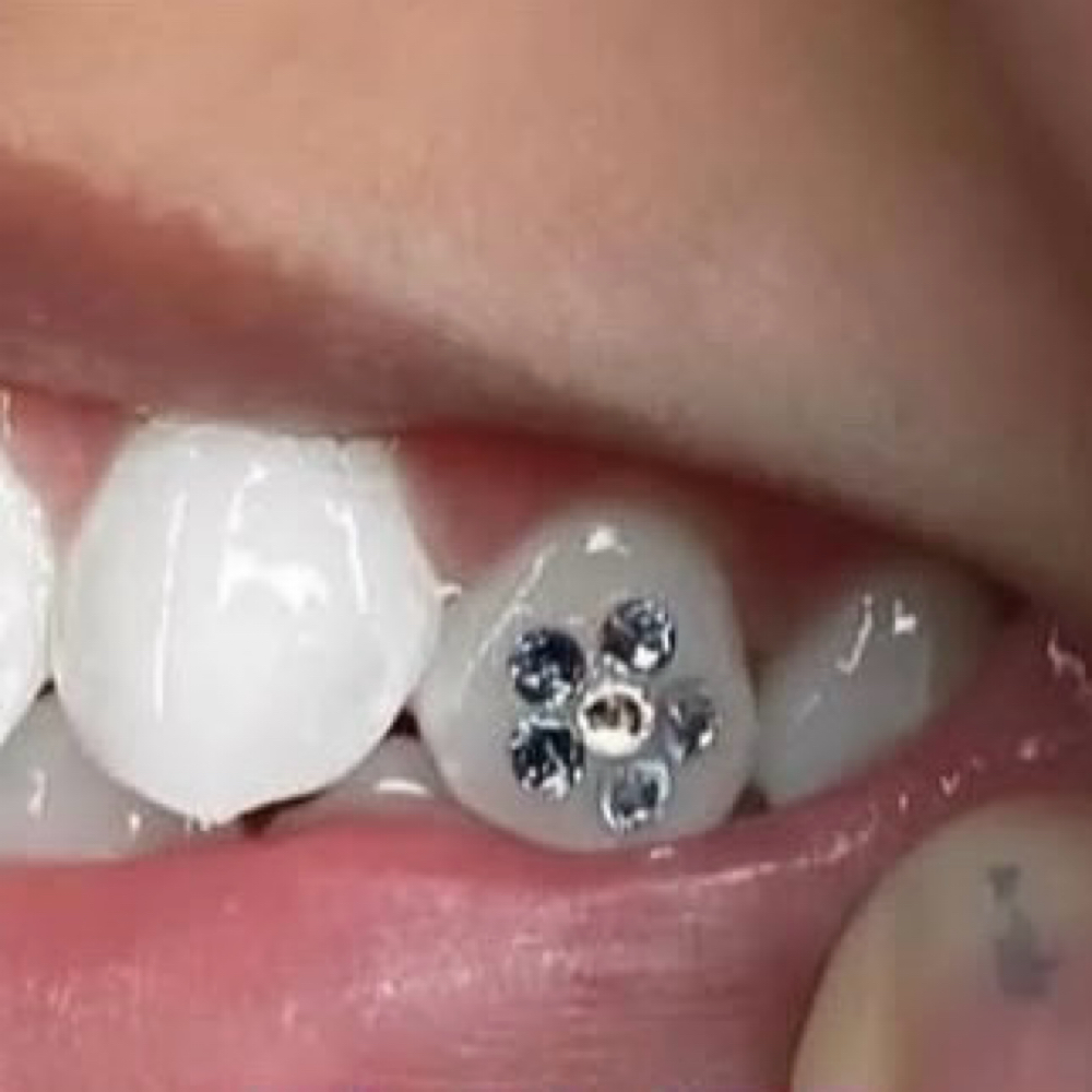 Tooth Gems at Polished.Arely in MIDLAND, TX
