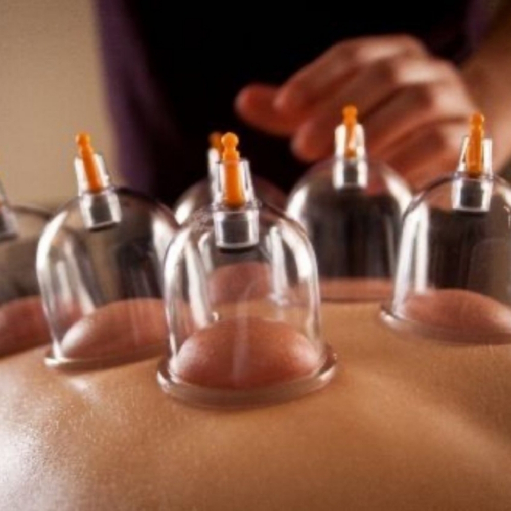Cupping (Add-on) at Bryant Salon and Spa in Sioux Falls, SD