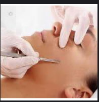 Dermaplaning Facial