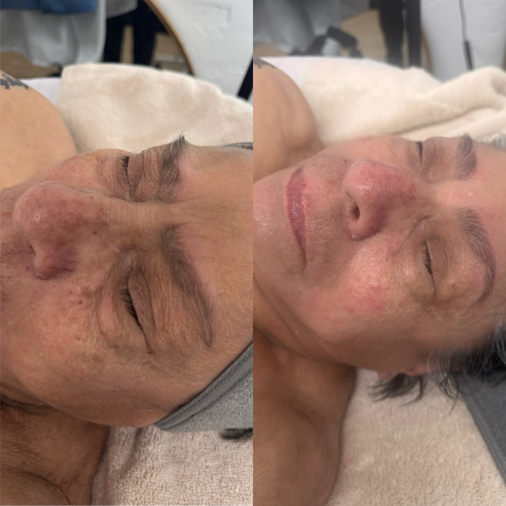 🤍Firming Facial at Skiin Pro Studio in Baldwin Park, CA
