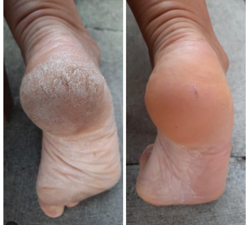 Callus removal at Brilliance Hair salon in Glendale, CA