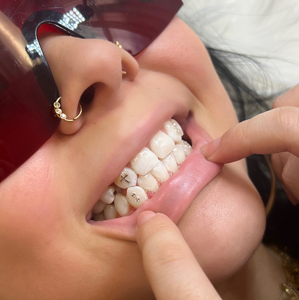 Tooth Gems