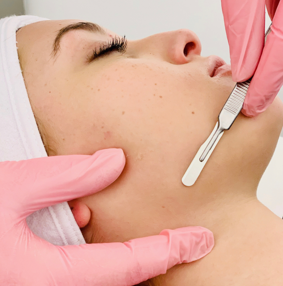 Add on Dermplane