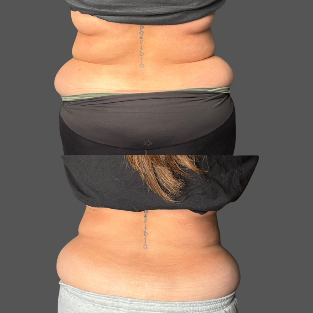 Body Sculpting Package (4/6/8/12) at Lashes By Emily98 in Kyle, TX
