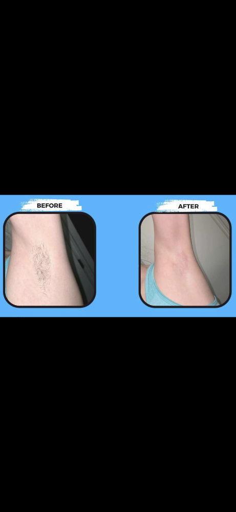 Underarm Wax