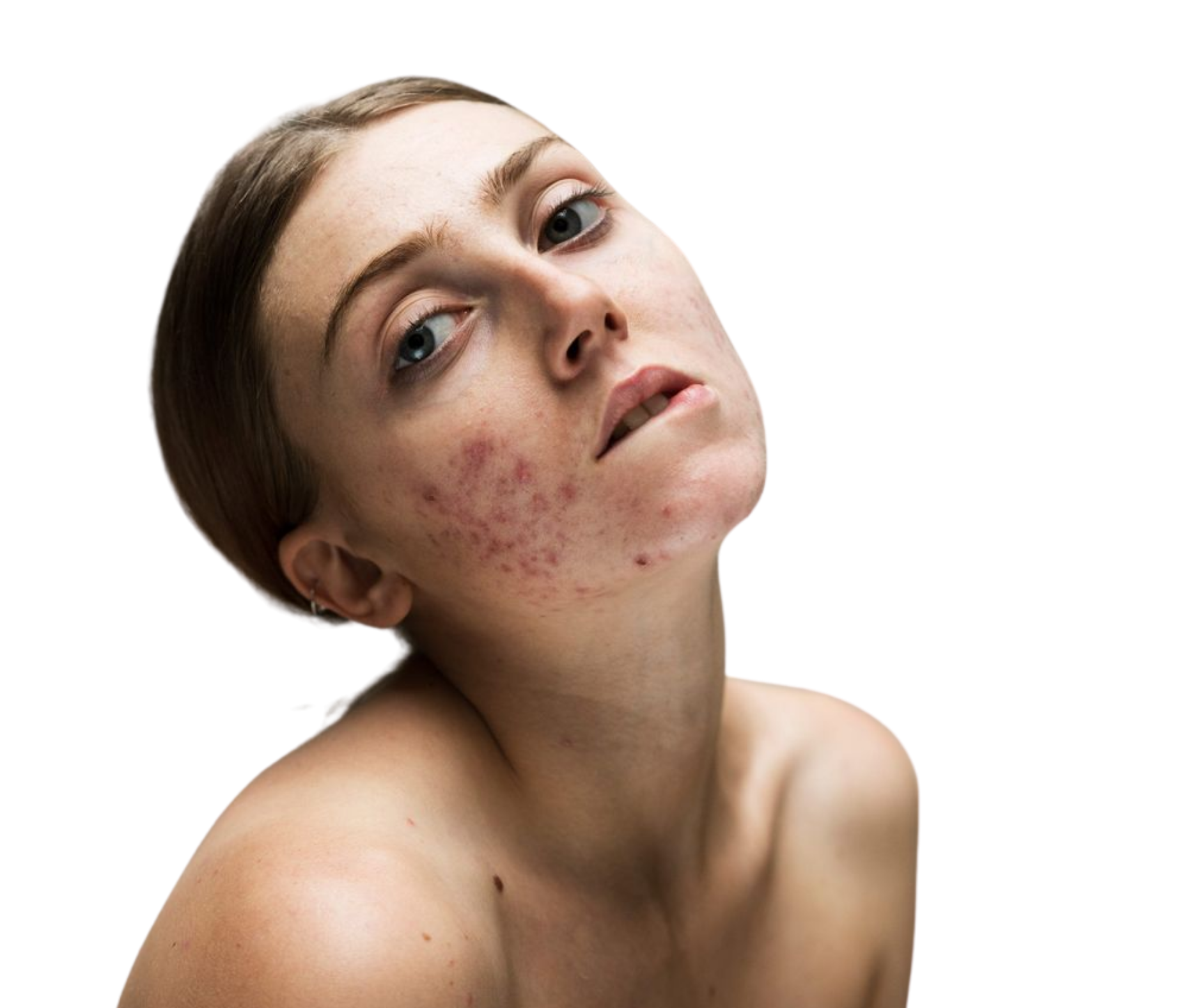 Clear Balance Facial at Haven Esthetic in Cape Coral, FL
