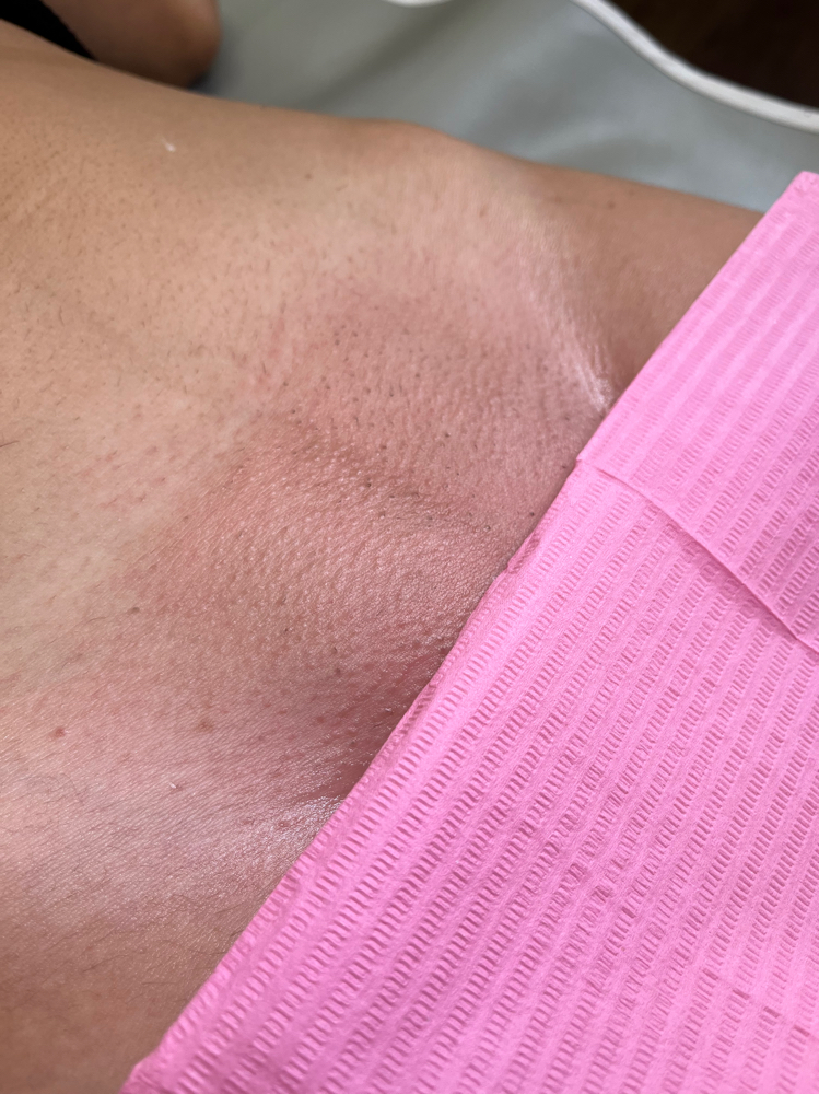 First Time Client Brazilian Wax
