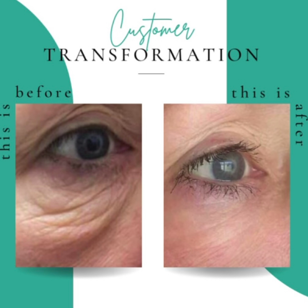 Nano Cold Plasma Rejuvenation at LĀ BEAUTY in Wilmington, MA