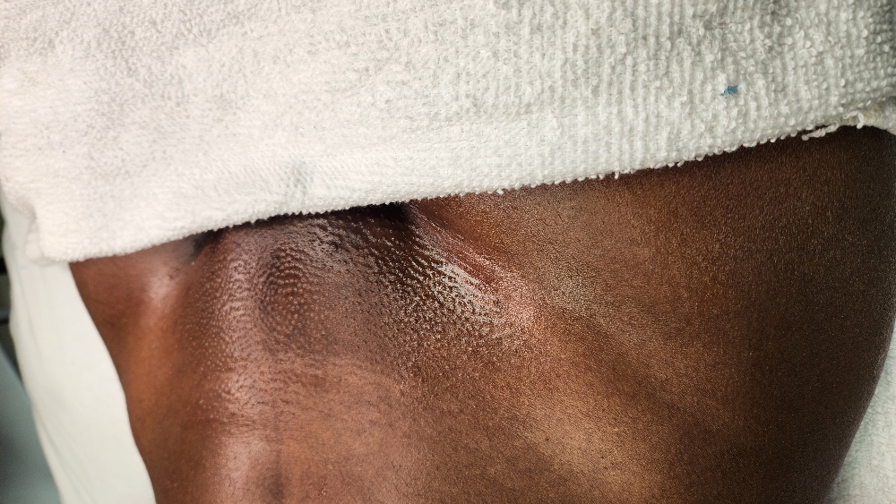 Brazilian Wax