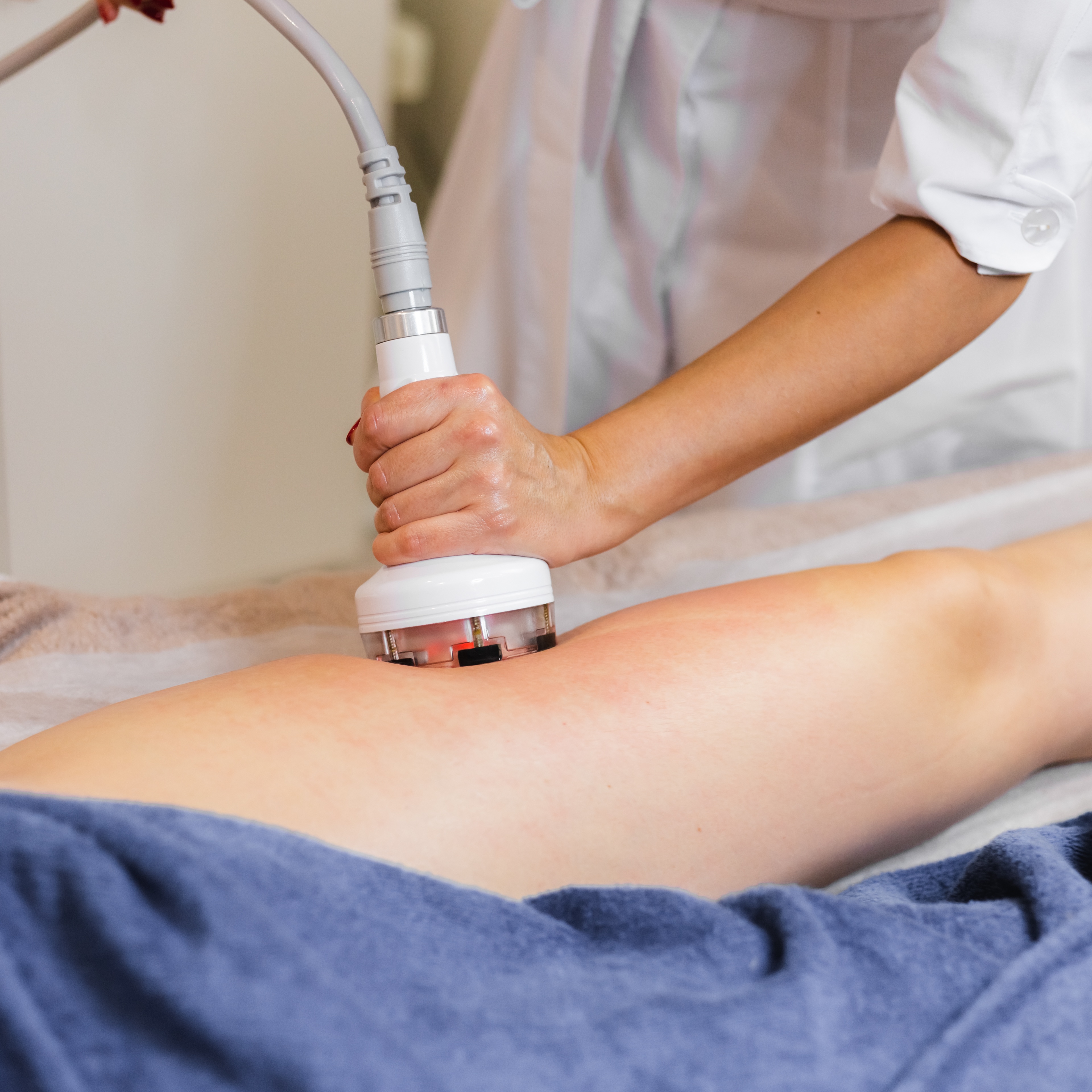 Cellulite Reduction - Legs or Butt at Radiantly Sculpted & Wellness in Hutto, TX