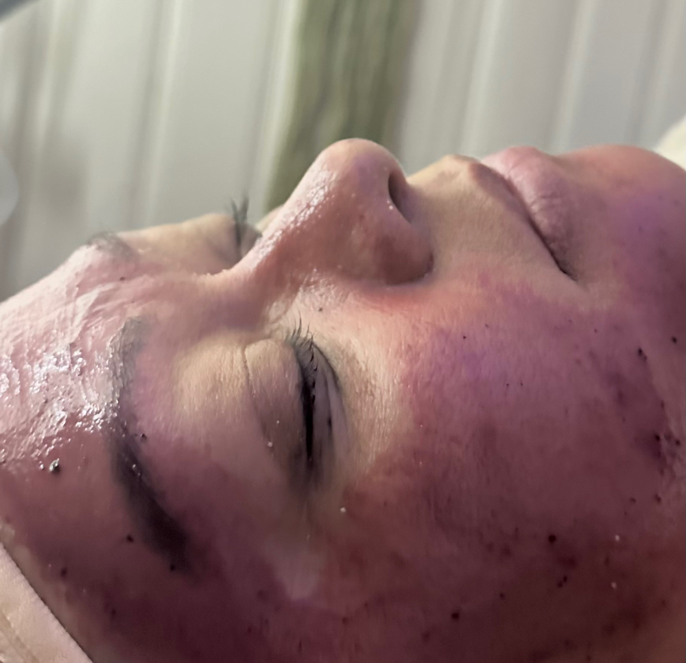 Ultimate Renewal Facial