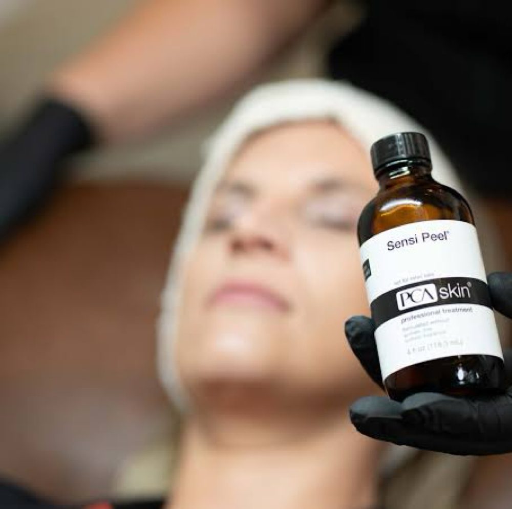 Chemical Peel at Dream Salon in Eagle Point, OR