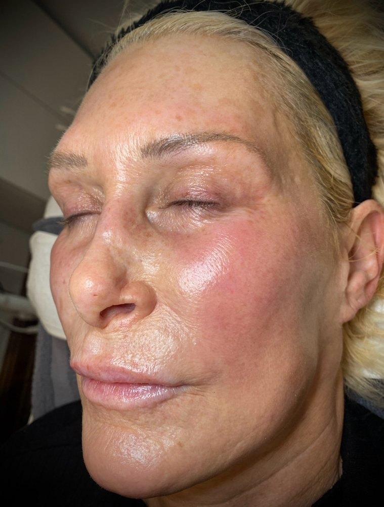 FauxTox Facial Ritual
