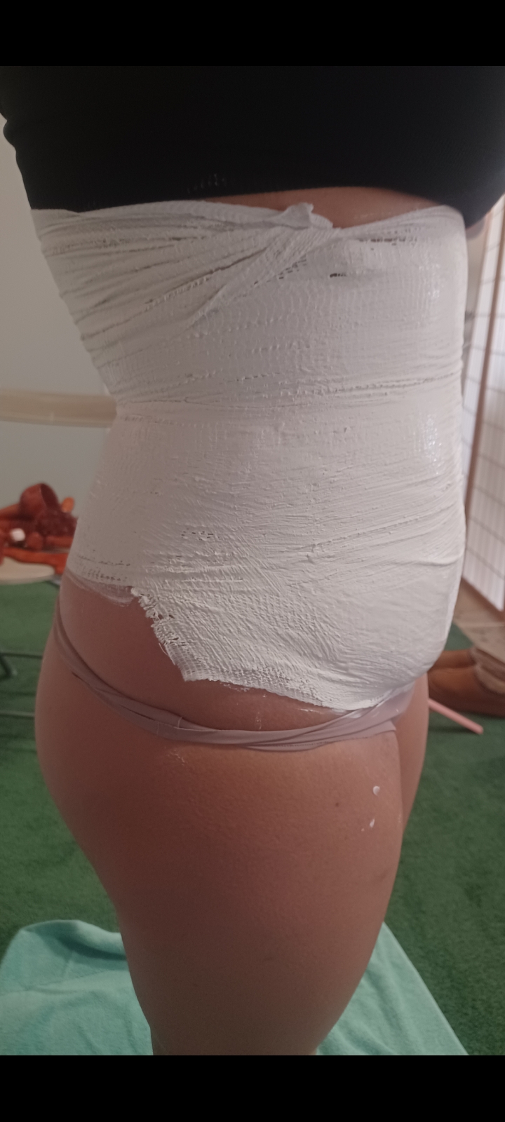 Yesoterapia reductiva