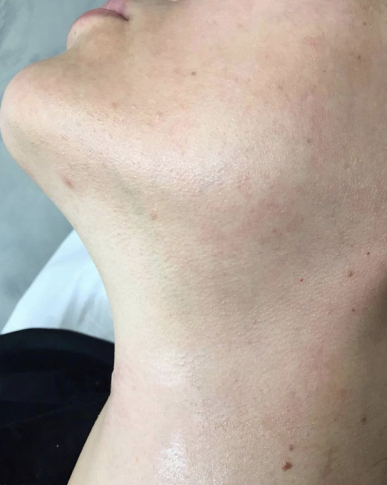 Neck Wax/ Cuello Con Cera
