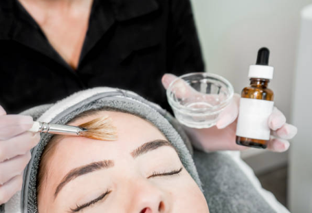 Chemical Peel