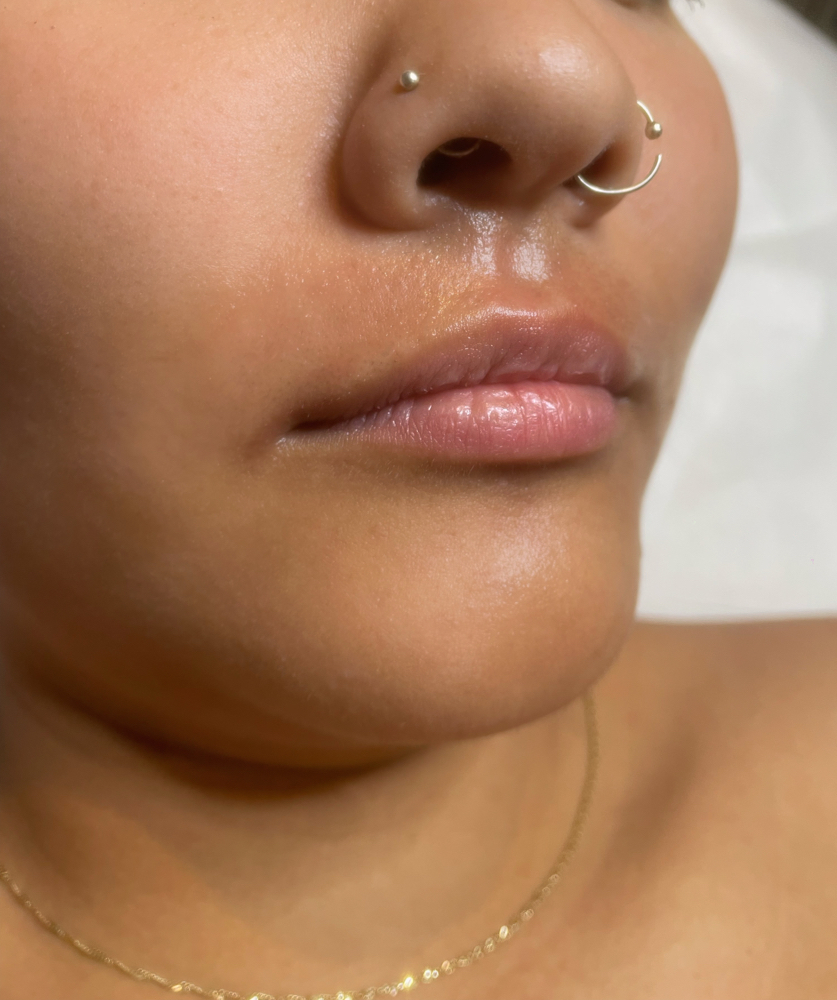 Upper Lip Waxing