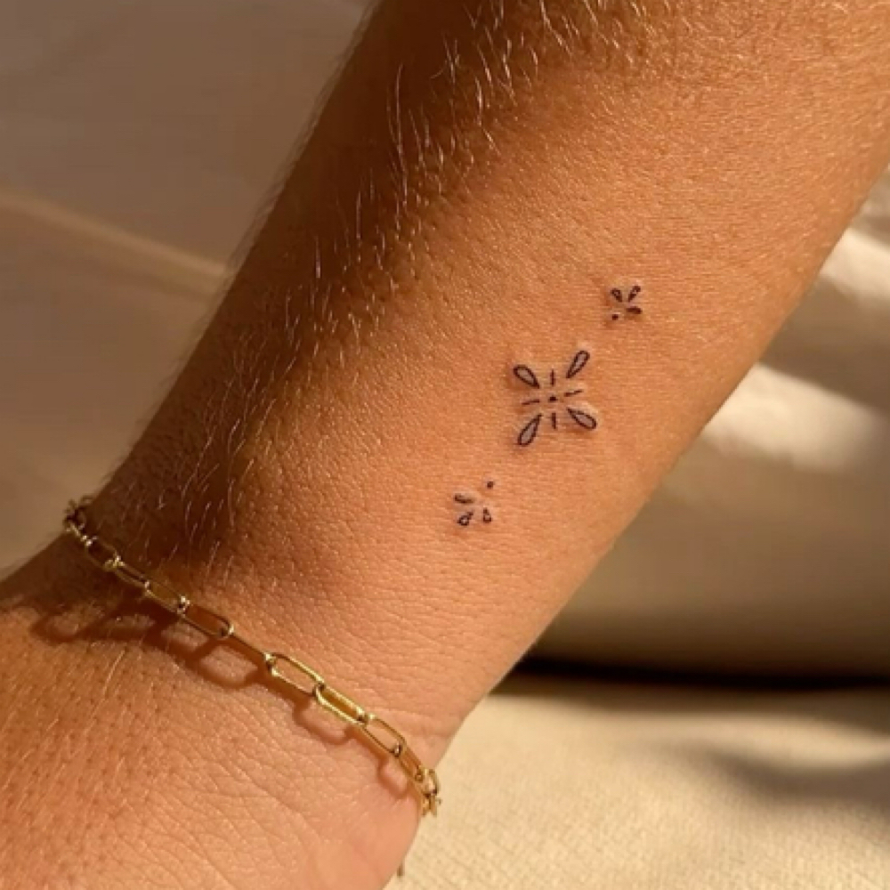 Tiny Tattoo Removal