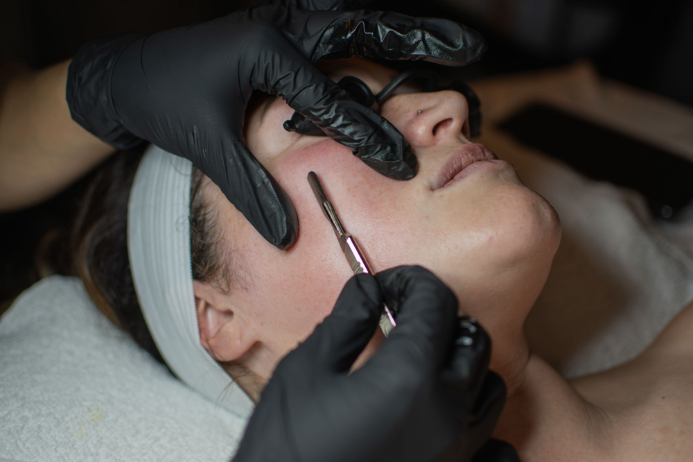 Dermaplane Facial