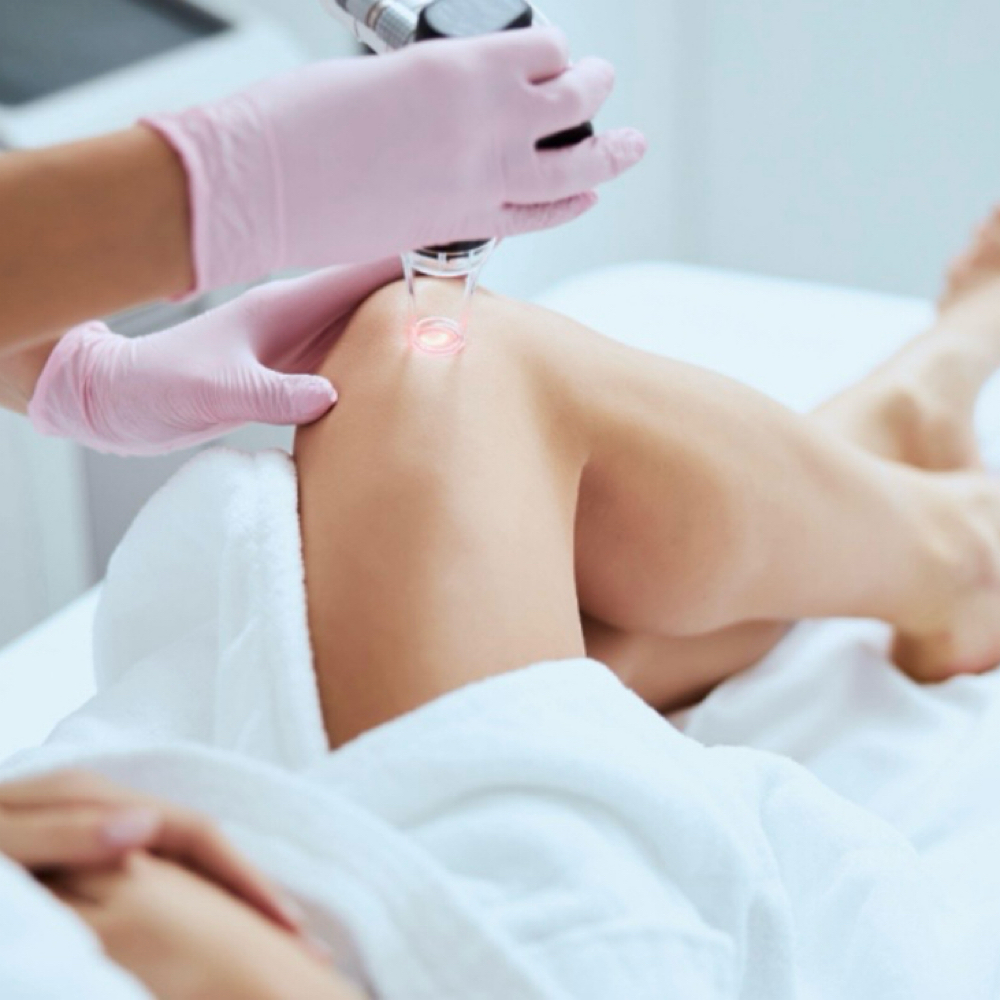 Spiral Vein Removal at Luvlookbeautyspa @GlossGenius in Las Vegas, NV