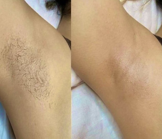 Armpit Wax