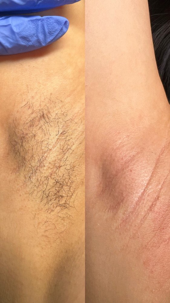 Armpit Wax