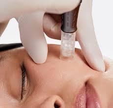 Nanoinfusion Treatment