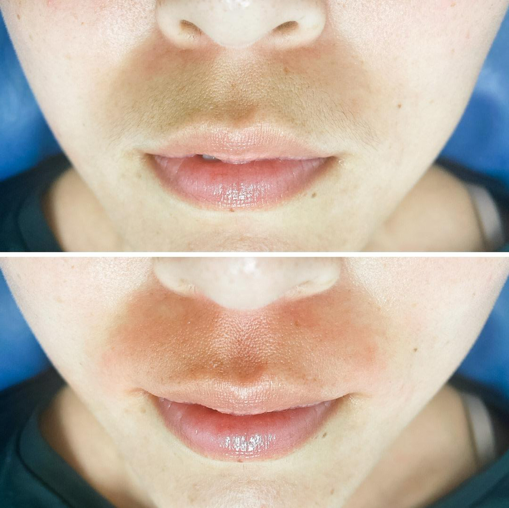 Upper-Lip at Belladz Wax Studio in Beltsville, MD