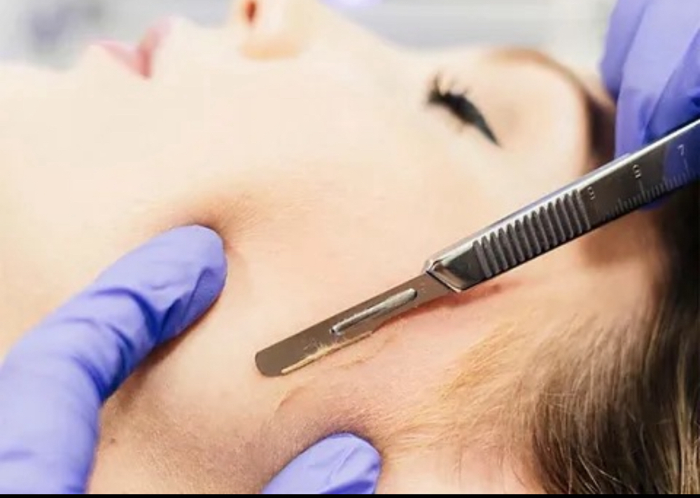 Dermaplane Only Treatment