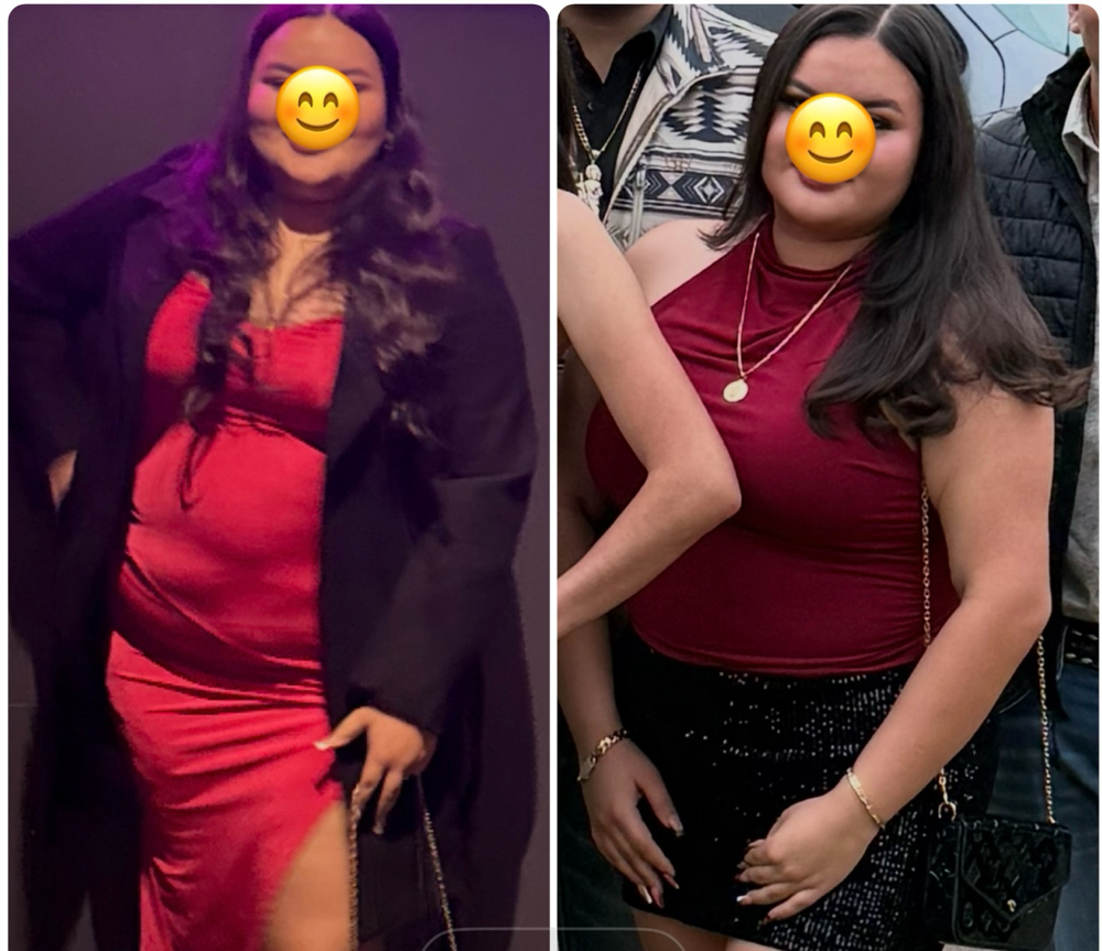 Weightloss- T at AllyouneedlexBB in Grand Praire, TX