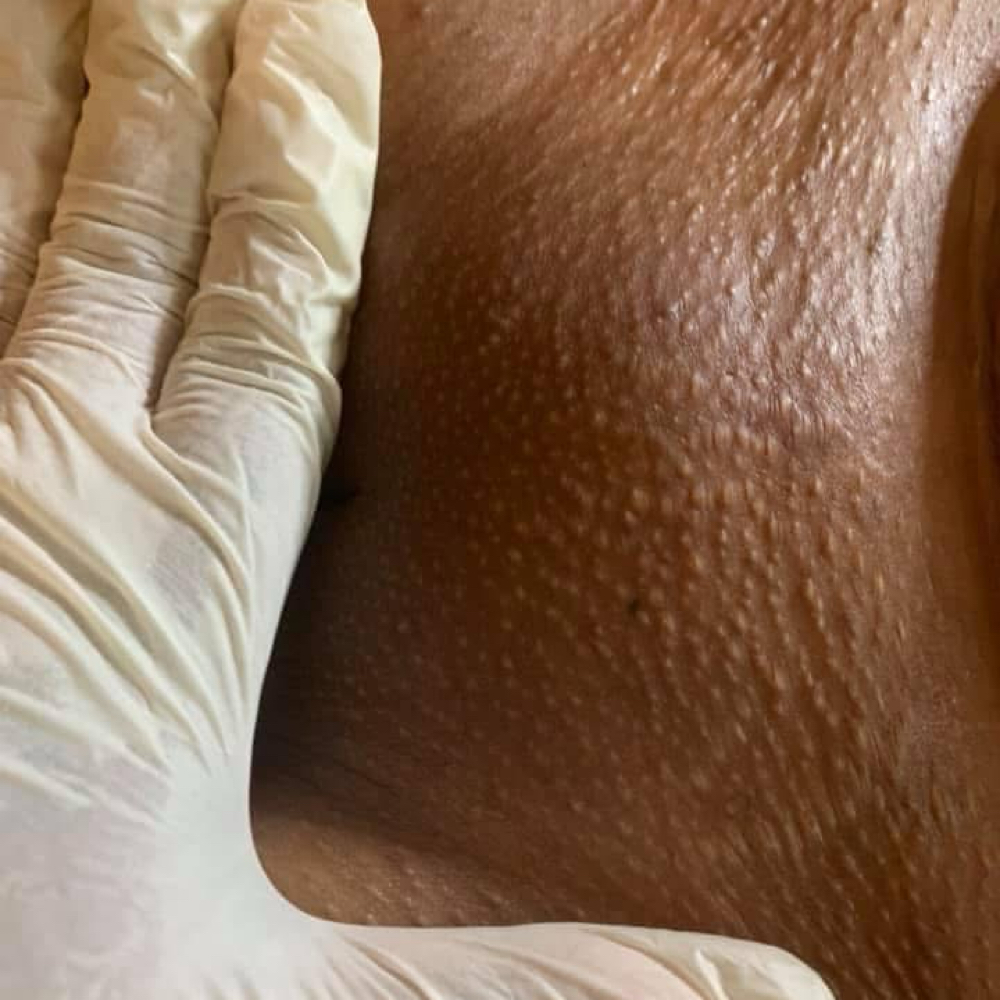 Brazilian Wax at Your Local Coochie Waxer in Louisville, KY