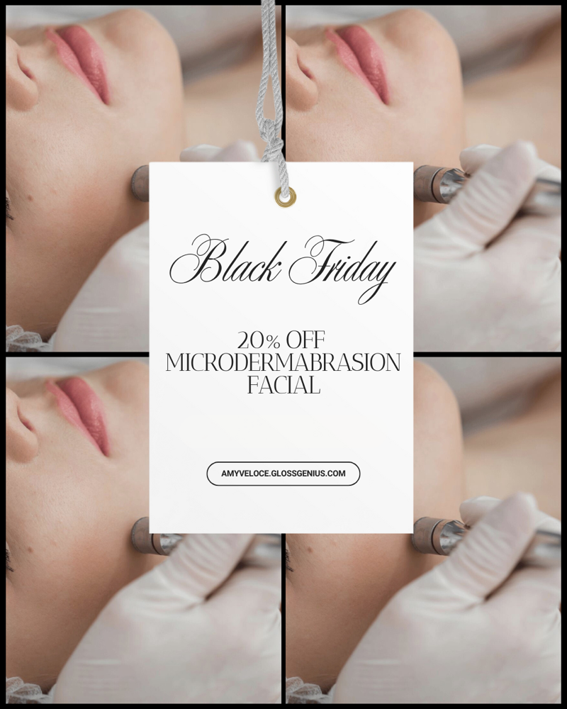 Black Friday Microdermabrasion