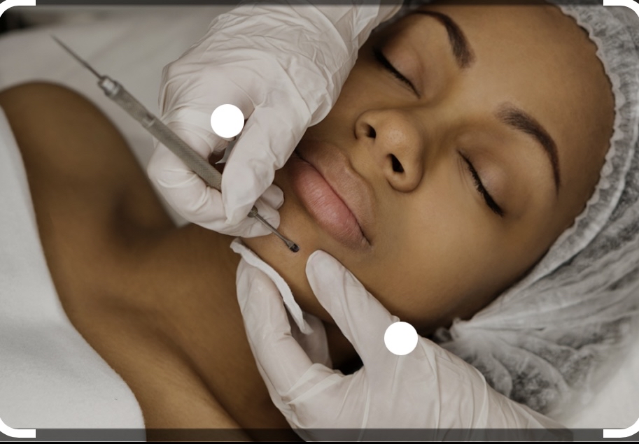 Extraction Facial